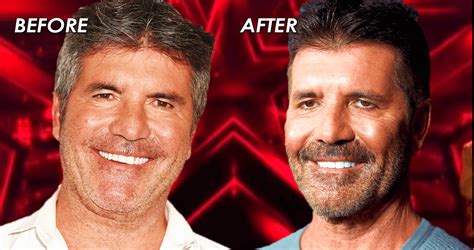 'AGT' Fans Shook: Is Simon Cowell's New Face Due To Vegan Diet Or Botox?