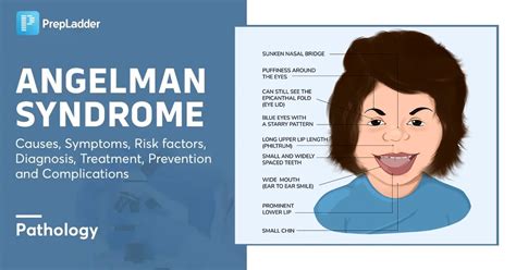 Angelman Syndrome: Causes, Symptoms, Risk Factors, Diagnosis, Treatment, Prevention and ...