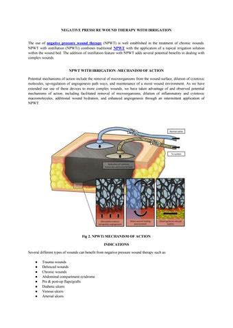 NEGATIVE PRESSURE WOUND THERAPY WITH IRRIGATION by Triage Meditech - Issuu