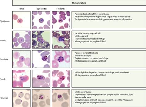 Malaria - The Lancet