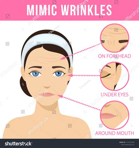 Different Types Facial Wrinkles Agerelated Skin Stock Vector (Royalty ...