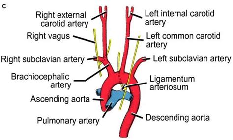 aortic arch branches | Eye health, Health facts, Metabolic disorders