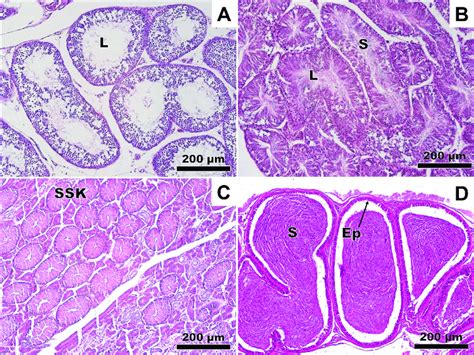 Histology of the reproductive tract of male Atractus zebrinus. (a)... | Download Scientific Diagram