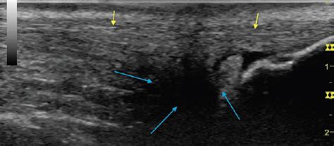 Imaging of Other Tissues | Radiology Key