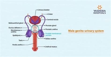 Male urethral stricture - The disease is as old as humanity - Yashoda ...