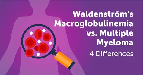 Waldenström’s Macroglobulinemia vs. Multiple Myeloma: 4 Differences ...