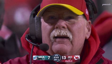 Andy Reid’s frozen mustache in horribly frigid Chiefs…