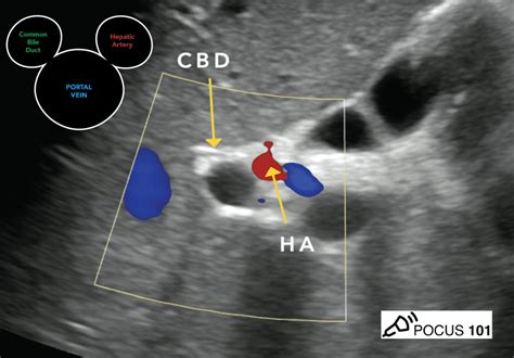 Abdominal Ultrasound Made Easy: Step-By-Step Guide POCUS, 53% OFF