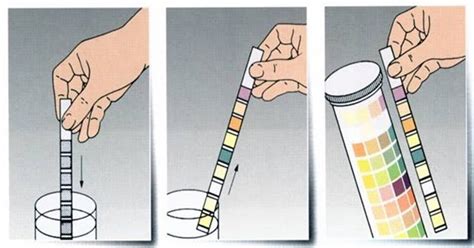 Urobilinogen Urin ~ Laboratorium Analysis