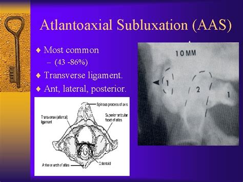 Cervical Spine Surgery For Patients with Rheumatoid Arthritis