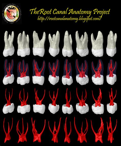 The Root Canal Anatomy Project: Maxillary First Molar