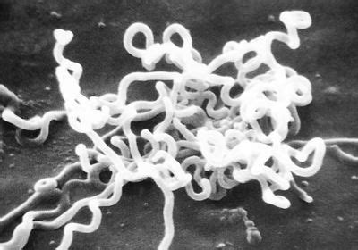 Science Falls Behind as Syphilis Stages Another Comeback | The ...