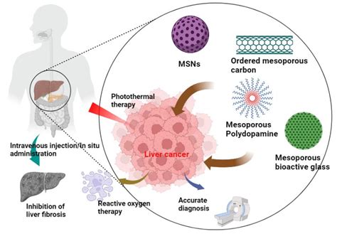 Pharmaceutics | Free Full-Text | Mesoporous Nanoparticles for Diagnosis and Treatment of Liver ...