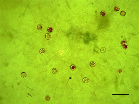 Ziehl-Neelsen Staining, Cryptosporidium parvum Oocysts in the Intestine... | Download Scientific ...