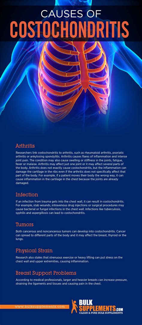 Tablo | Read 'Costochondritis: Causes, Symptoms & Treatment' by