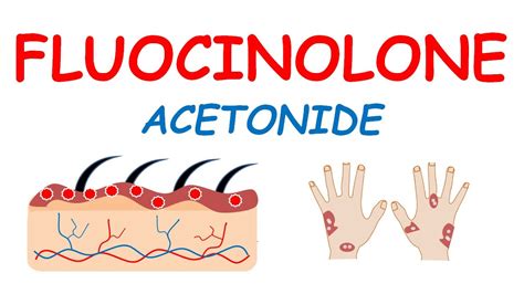 Fluocinolone acetonide cream -Mechanism, precautions & side effects - YouTube