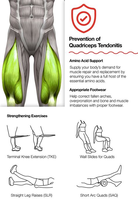 Treatment Quadriceps Tendonitis - 3 Ways to Treat Quadriceps Tendonitis - wikiHow - Quadriceps ...