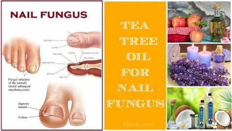 14 useful ways on how to use tea tree oil for nail fungus