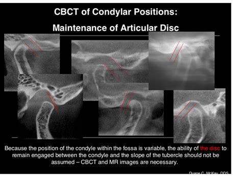 Rise & Shine, The Book - Head / TMJ: Assessment of Form and Function