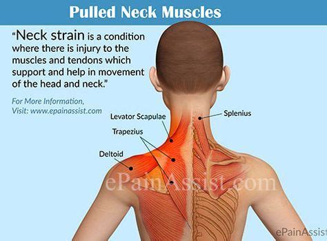 Pulled Neck Muscle or Neck Strain | Salud fisica, Ejercicios, Salud