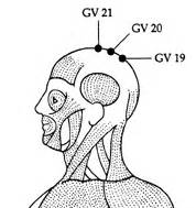 Acupressure, meridian points, acupressure for depression, Depression, Traditional Chinese ...