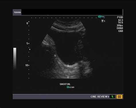 Ultrasound imaging: A simple sonography quiz about male pelvis