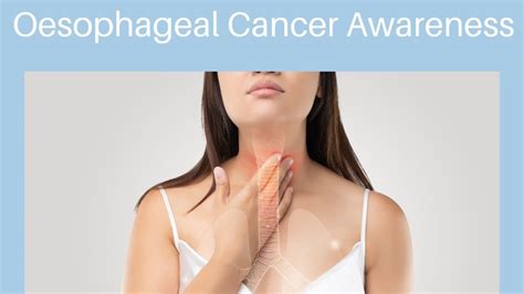 Oesophageal Cancer: Risk factors, symptoms, diagnosis, treatment, prevention tip | Health ...