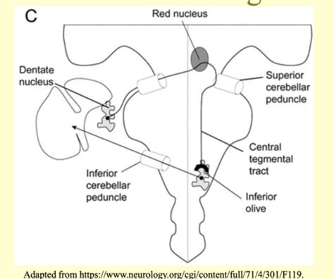 Lecture 33: Cerebellar and Basal Ganglia Movement Disorders and Treatments Flashcards | Quizlet
