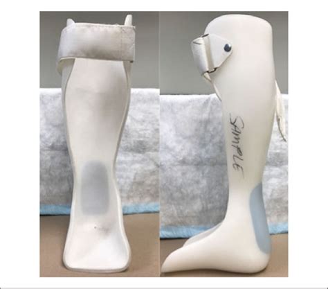 The molded ankle-foot orthosis (MAFO). | Download Scientific Diagram