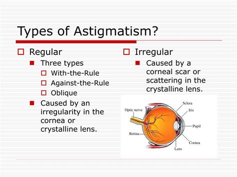 PPT - ASTIGMATISM PowerPoint Presentation, free download - ID:1428237