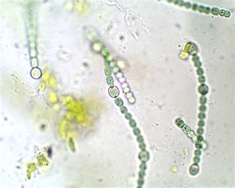 Anabaena Heterocysts