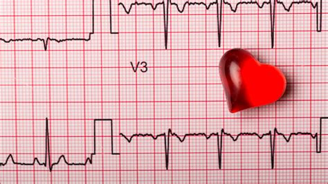 Simple Guidance For You In Home Healthcare [Can An Ekg Detect A Heart Attack?]