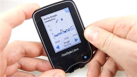 Living with a Freestyle Libre NFC No-Prick Diabetic Blood Glucose Monitoring system - YouTube