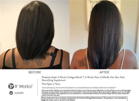 collagen for hair before and after - Great Bear E-Zine Pictures