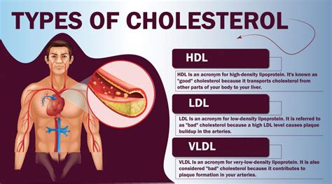 High Cholesterol - Symptoms, Cause, Risk Factor | Kayawell