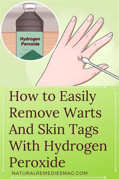 Does Hydrogen Peroxide Really Work For Dead Skin Removal? | Heidi Salon