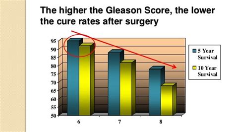 Prostate Cancer and Gleason Score