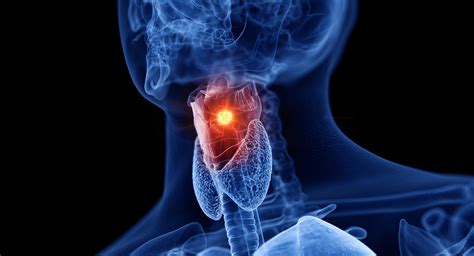 Understanding Larynx Cancer - Ask The Nurse Expert