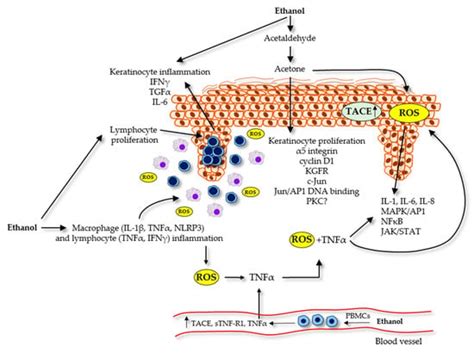 IJMS | Free Full-Text | Alcohol in Psoriasis—From Bench to Bedside