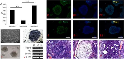 Derivation and characteristics of iPS cells from different somatic ...