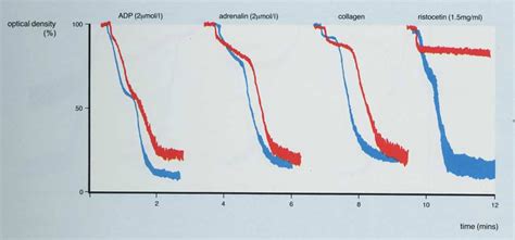 Platelet Function Testing: Light Transmission Aggregometry