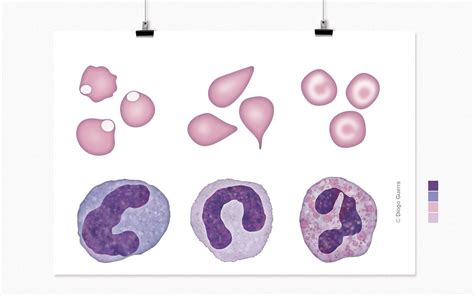 Medical and Veterinary Illustration by Diogo Guerra - CLINICAL PATHOLOGY FLASHCARDS