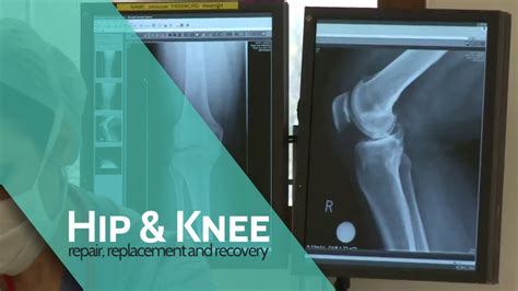 Hip & Knee | Osteotomy