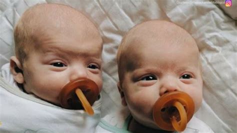 Twins DNA Testing: Identical or Fraternal? | DNA Diagnostics Center