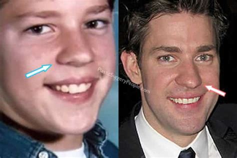 John Krasinski Did NOT Have Nose Job and Here's Proof