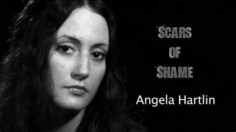 "Scars of Shame" - Trailer (Dermatillomania) - YouTube