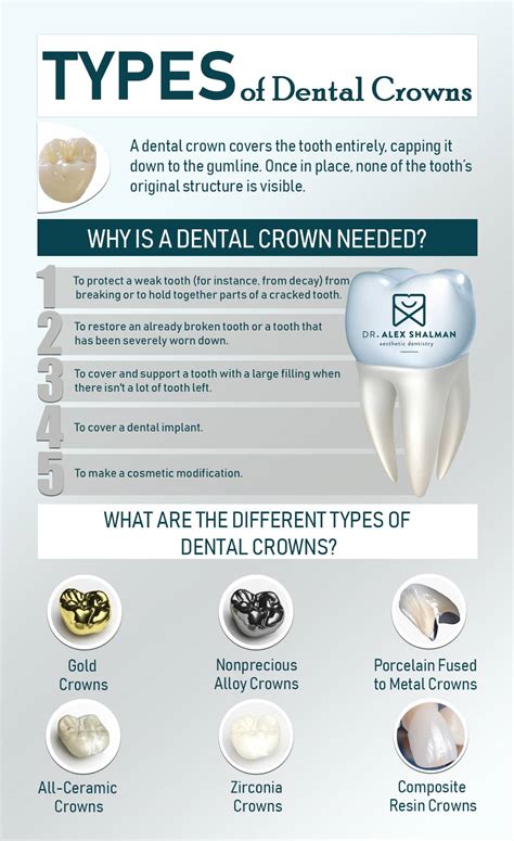 Cavity Filling Types | tunersread.com