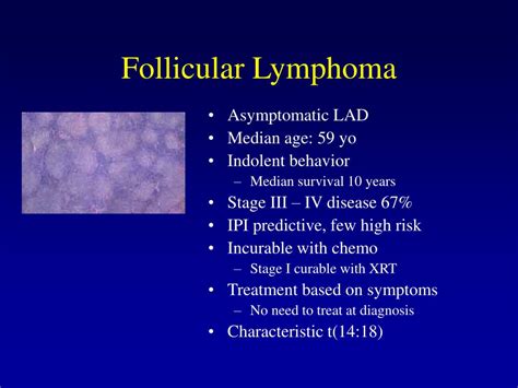 PPT - Lymphoma Presentation and Diagnosis PowerPoint Presentation, free ...