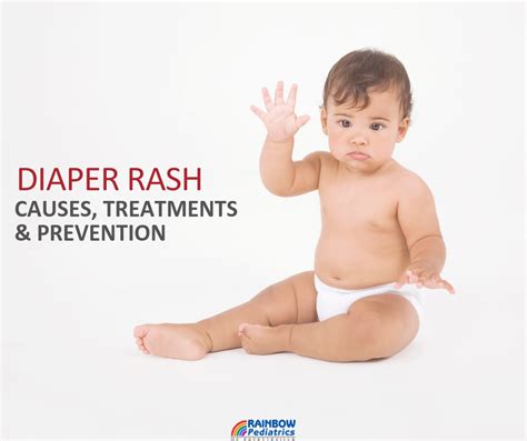 Diaper Rash: Causes, Treatments, & Prevention - Rainbow Pediatrics : Rainbow Pediatrics