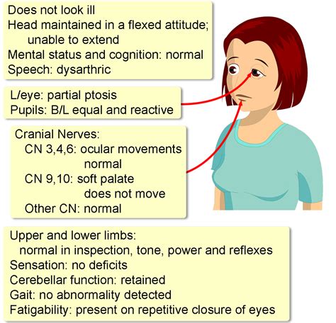 Myasthenia Gravis - Interactive case study | Clinical Odyssey by ...